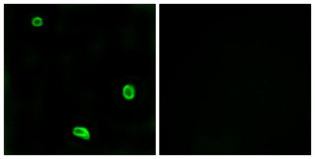 Anti-PAR4 antibody produced in rabbit