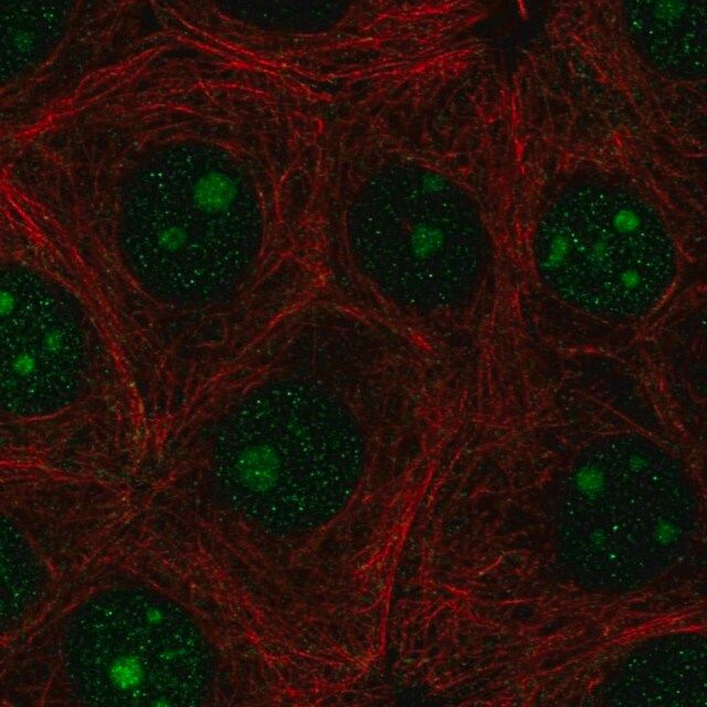 Anti-PAQR6 antibody produced in rabbit