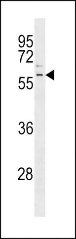 ANTI-PARKIN(C-TERMINAL) antibody produced in rabbit