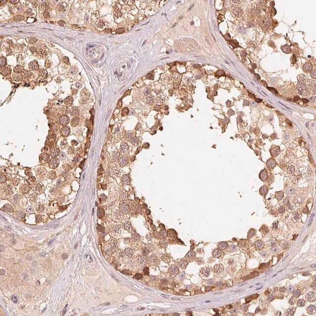 Anti-PARK2 antibody produced in rabbit