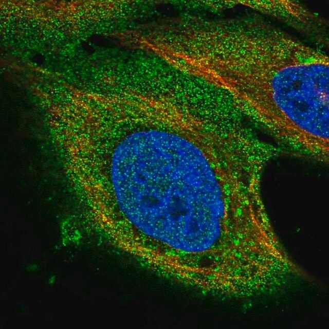 Anti-PAQR8 antibody produced in rabbit