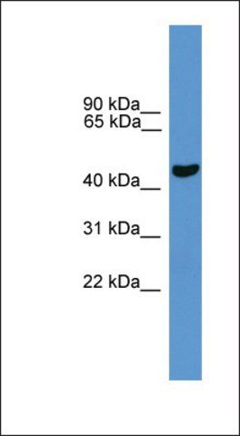 Anti-PARK2 antibody produced in rabbit