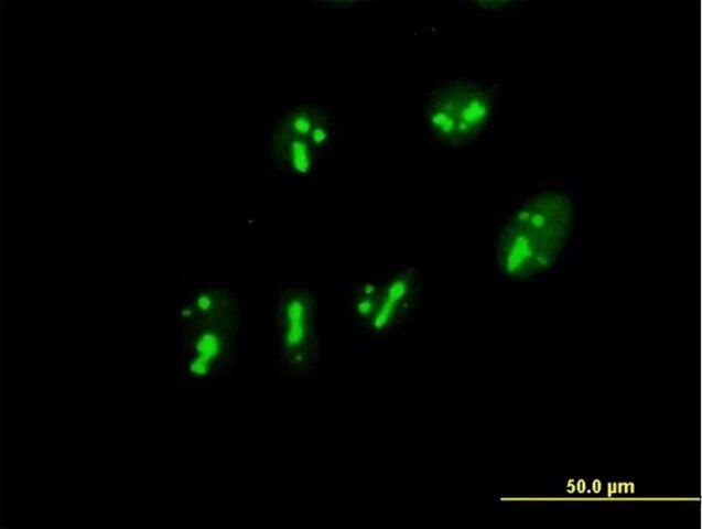 Anti-PARN antibody produced in mouse