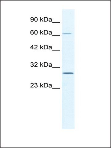 Anti-PARP11 antibody produced in rabbit