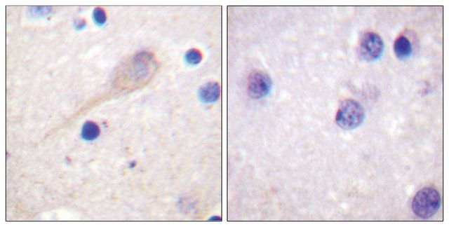 Anti-Parkin antibody produced in rabbit