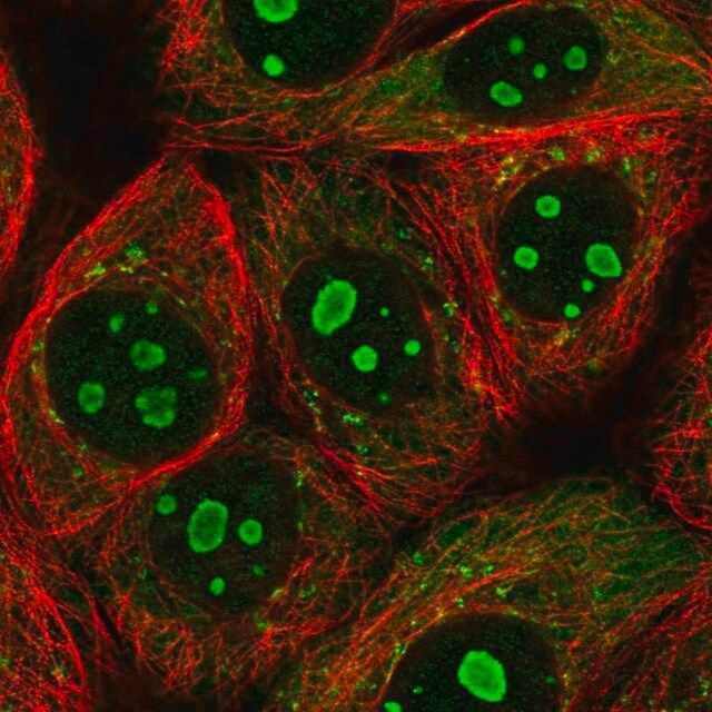 Anti-PARP10 antibody produced in rabbit