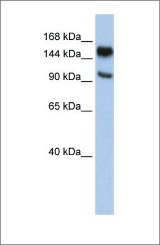 Anti-PARP10 antibody produced in rabbit