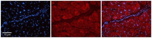 Anti-PARP16 antibody produced in rabbit