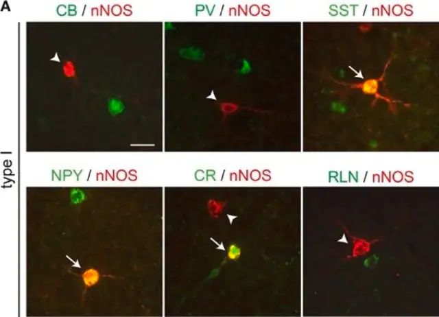 Anti-Parvalbumin Antibody