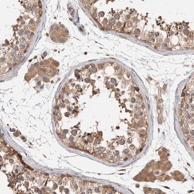 Anti-PARP6 antibody produced in rabbit