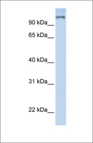 Anti-PARP9 antibody produced in rabbit