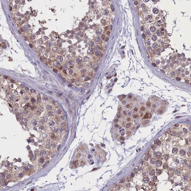 Anti-PARS2 antibody produced in rabbit