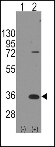 Anti-PARP16 (N-term) antibody produced in rabbit