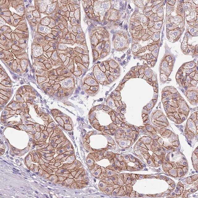 Anti-PARP8 antibody produced in rabbit