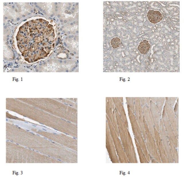 Anti-Parvin alpha Antibody, clone 7E2.1