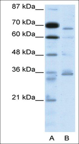 Anti-PCSK6 antibody produced in rabbit