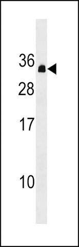 ANTI-PDCD10 (CENTER) antibody produced in rabbit