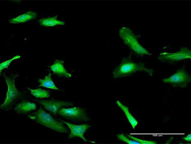 Anti-PDCD2 antibody produced in rabbit