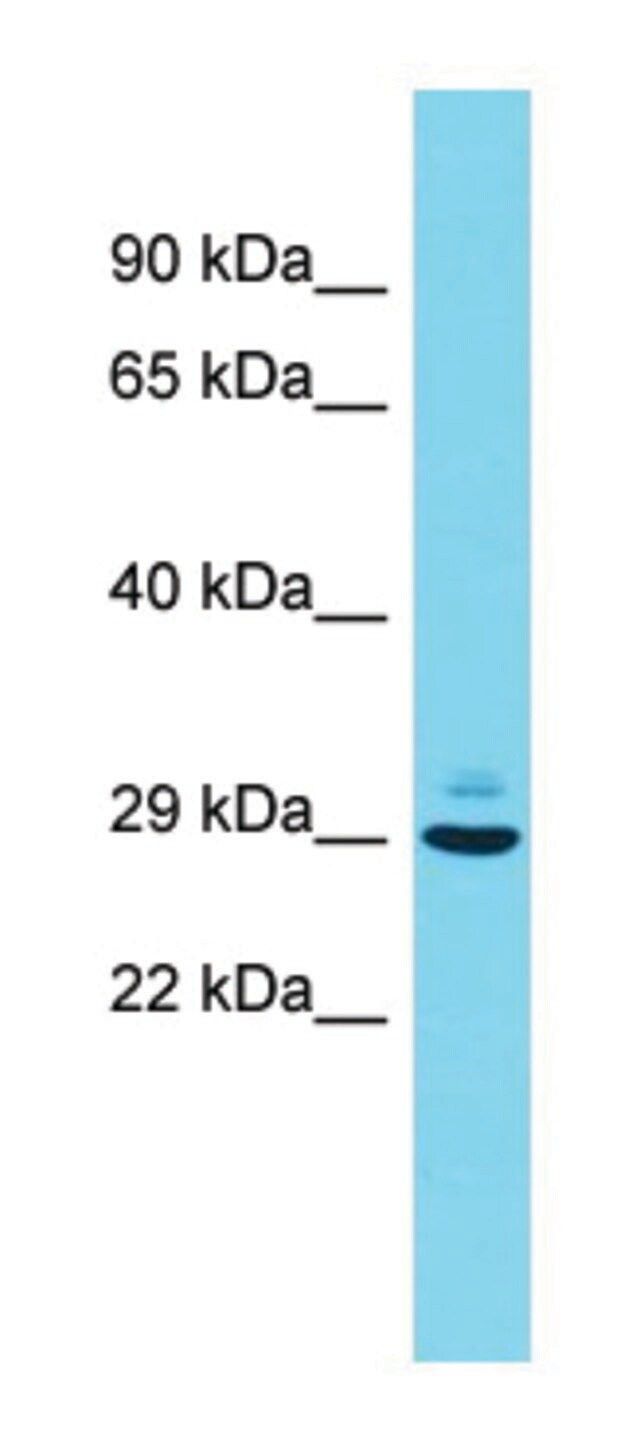 Anti-Pcsk1n (N-terminal) antibody produced in rabbit