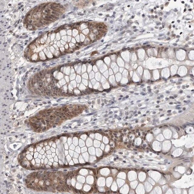 Anti-PDCL3 antibody produced in rabbit