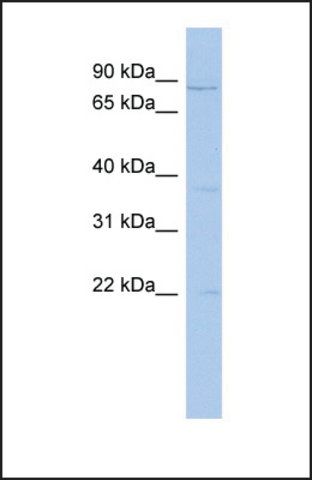 Anti-PCSK4, (N-terminal) antibody produced in rabbit