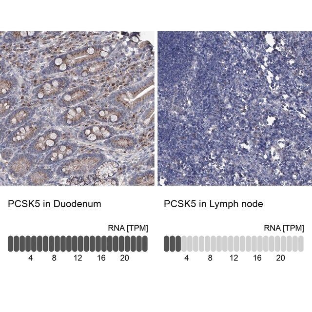 Anti-PCSK5 antibody produced in rabbit