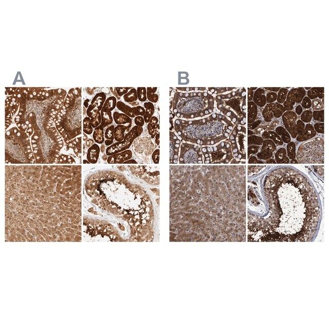 Anti-PCYT2 antibody produced in rabbit