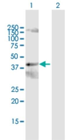 Anti-PCYT2 antibody produced in rabbit