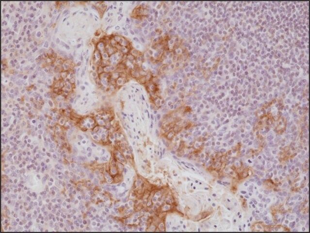 Anti-PD-L1antibody, Rabbit Monoclonal