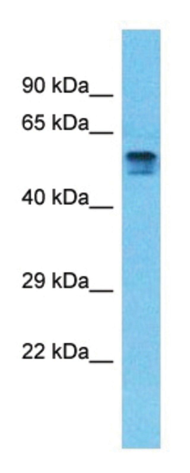 Anti-PDE4D (C-terminal) antibody produced in rabbit