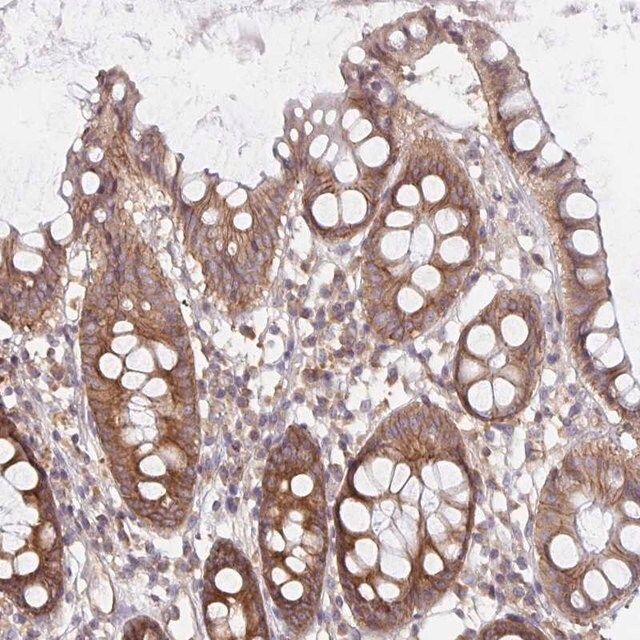 Anti-PDAP1 antibody produced in rabbit