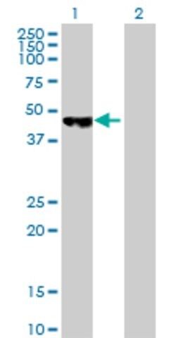 Anti-PCYT2 antibody produced in mouse