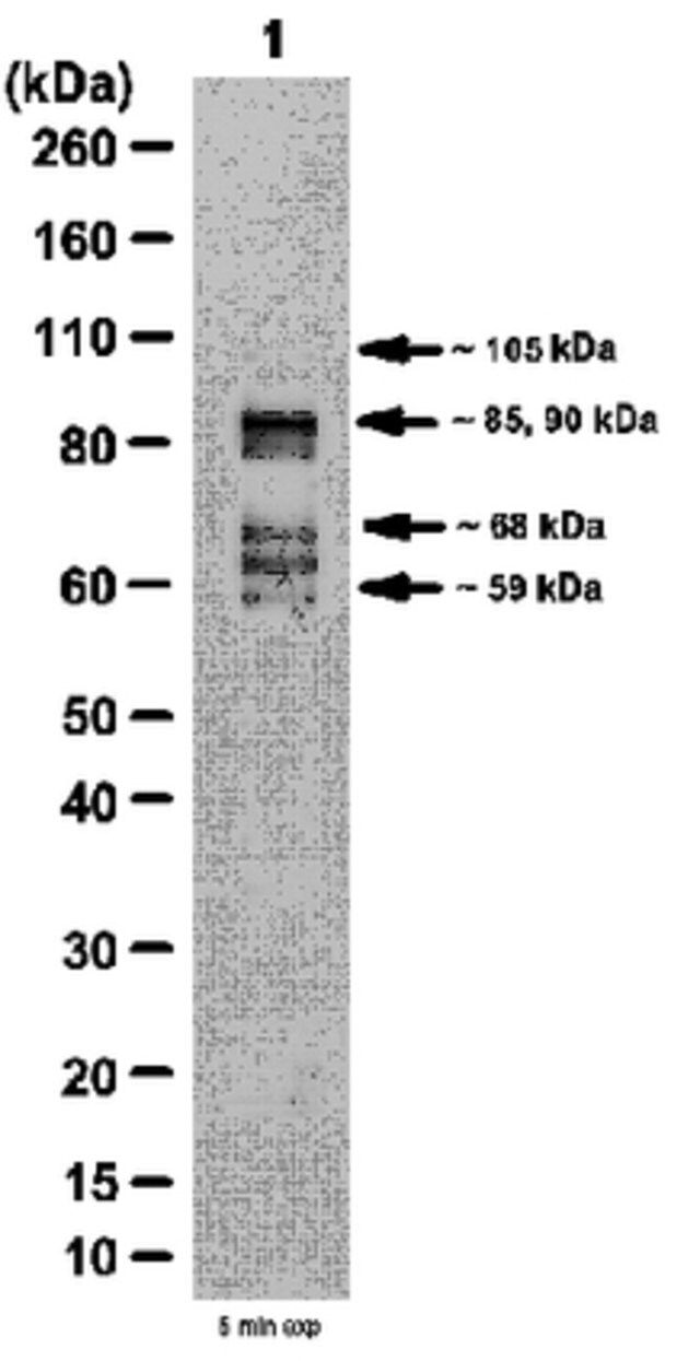 Anti-PDE4D Antibody