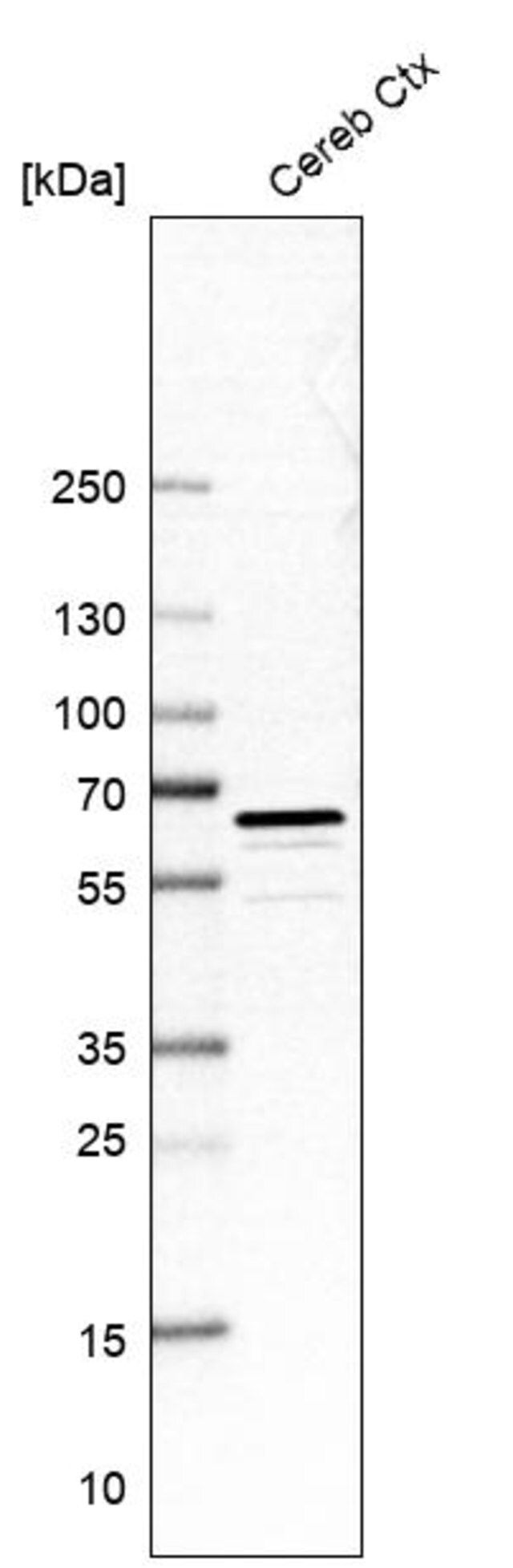 Anti-PDE1B antibody produced in rabbit