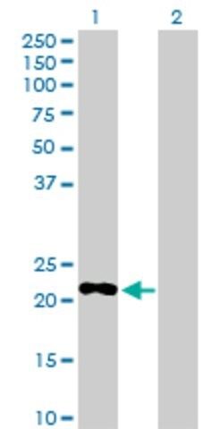 Anti-PDE4DIP antibody produced in rabbit