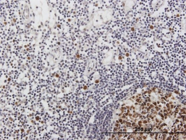 Anti-ORC6L antibody produced in mouse