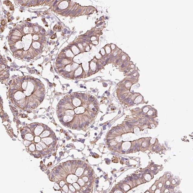 Anti-OR13D1 antibody produced in rabbit