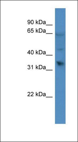 Anti-OR1D2 antibody produced in rabbit