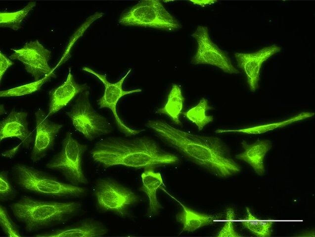 Anti-OTUB2 antibody produced in rabbit