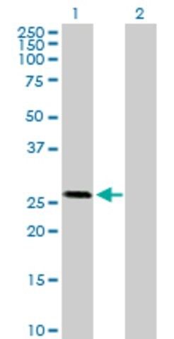 Anti-OTUB2 antibody produced in mouse