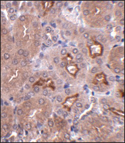 Anti-OTUD5 antibody produced in rabbit