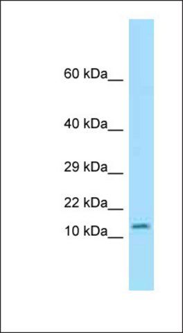 Anti-OTOS antibody produced in rabbit