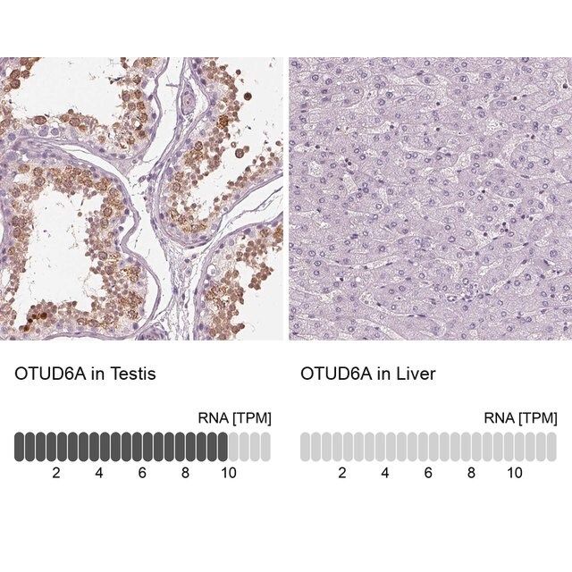 Anti-OTUD6A antibody produced in rabbit