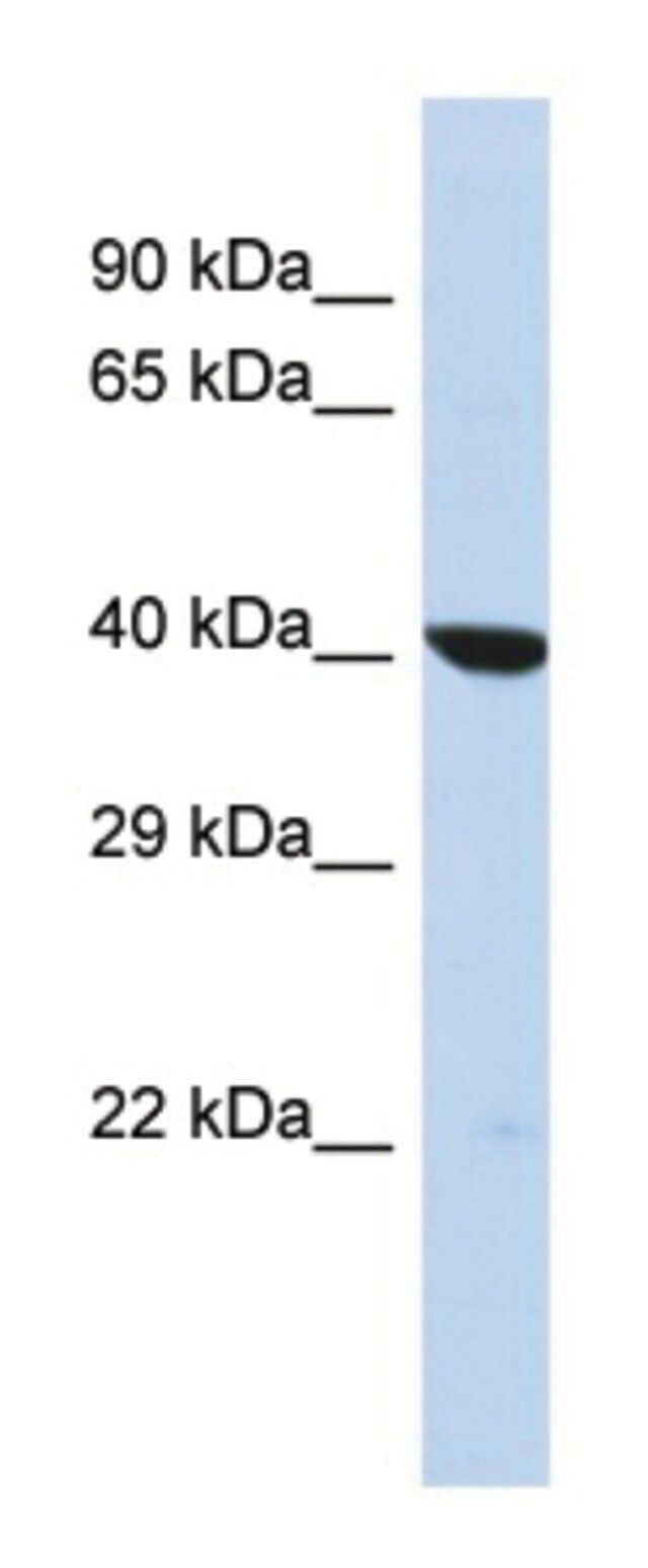 Anti-OXA1L (C-terminal) antibody produced in rabbit