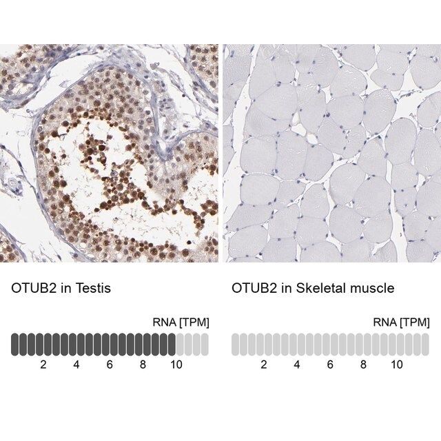 Anti-OTUB2 antibody produced in rabbit