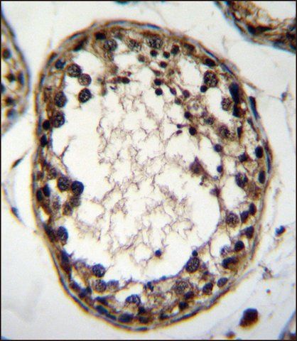 ANTI-OTUD1 (CENTER) antibody produced in rabbit