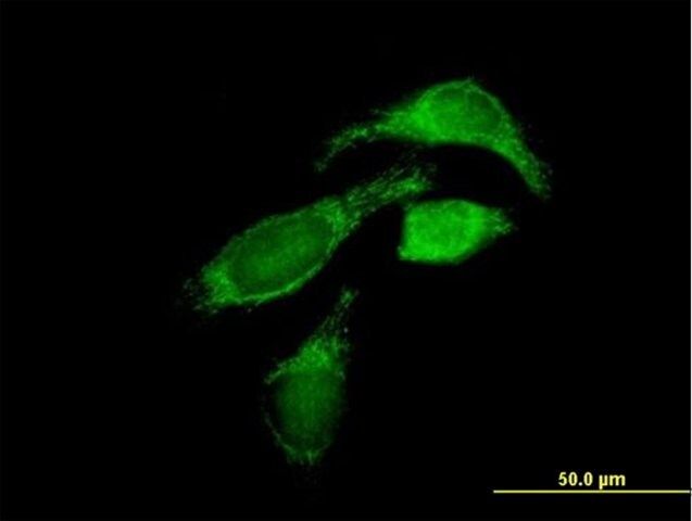 Anti-OXCT1 antibody produced in mouse