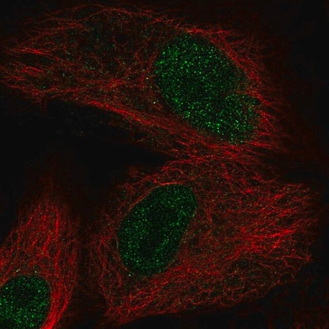 Anti-OXNAD1 antibody produced in rabbit