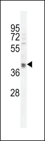 ANTI-OTUD3 (CENTER) antibody produced in rabbit