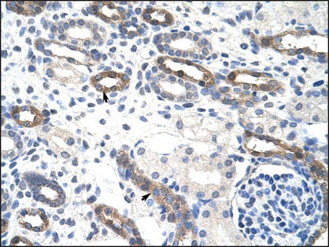 Anti-OVOL1 antibody produced in rabbit